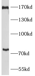 PLXNB2 antibody|PLXNB2抗体