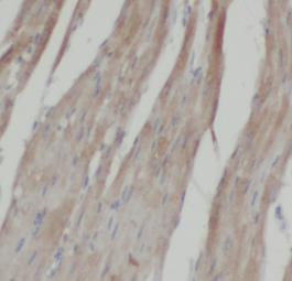 LPAR3 antibody|LPAR3抗体