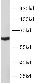 METTL14 antibody|METTL14抗体