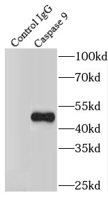 BRD8 antibody|BRD8抗体 FNab00949