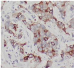 EIF4EBP1 antibody|EIF4EBP1抗体 F