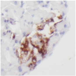 CHGA antibody|CHGA抗体 FNab01687