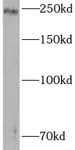 TJP1 antibody|TJP1抗体 FNab09750