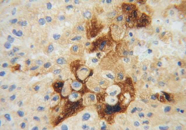 APOH antibody|APOH抗体 FNab00509