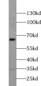 UROC1 antibody|UROC1抗体