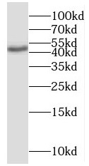 SMAD4 antibody|SMAD4抗体 FNab079