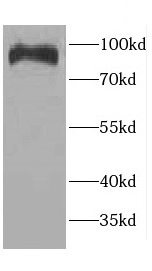 CCDC40 antibody|CCDC40抗体