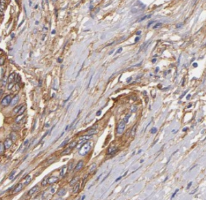 ITGB6 antibody|ITGB6抗体