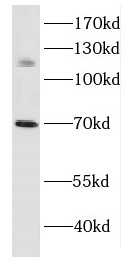 DAXX antibody|DAXX抗体
