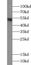 TINAGL1 antibody|TINAGL1抗体