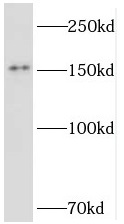 TMF1 antibody|TMF1抗体