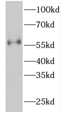 FKBP4 antibody|FKBP4抗体 FNab031