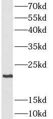 SFTPC antibody|SFTPC抗体