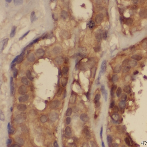 PPP2R2C antibody|PPP2R2C抗体