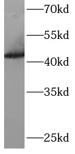 ARFGAP1 antibody|ARFGAP1抗体 FNa