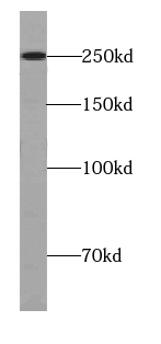 URB1-Specific antibody|URB1抗体