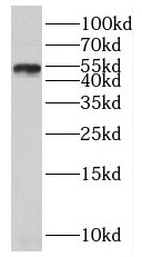 SLC30A6 antibody|SLC30A6抗体