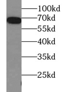 HSPA1A antibody|HSPA1A抗体 FNab0