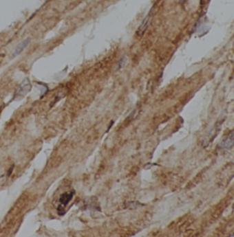 CLPX antibody|CLPX抗体