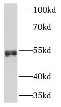 NFIB antibody|NFIB抗体