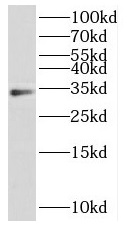 HOXD11 antibody|HOXD11抗体