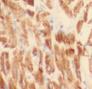 APAF1 antibody|APAF1抗体