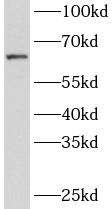 ZNF571 antibody|ZNF571抗体