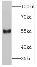 PDCD7 antibody|PDCD7抗体