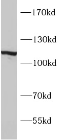 SYNPO antibody|SYNPO抗体