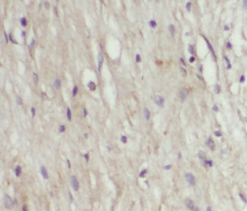 CXCL17 antibody|CXCL17抗体