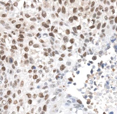 ALKBH5 antibody|ALKBH5抗体