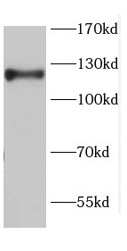 CDH17 antibody|CDH17抗体