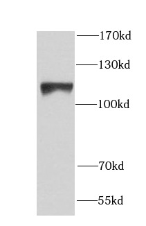 NCL antibody|NCL抗体