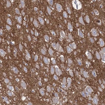 SYNPO antibody|SYNPO抗体