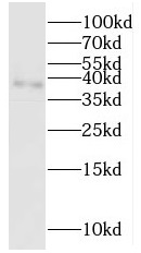 PPA2 antibody|PPA2抗体