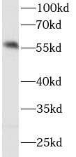 IRF5 antibody|IRF5抗体 FNab04392
