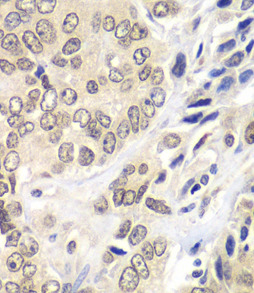 RNF2 antibody|RNF2抗体