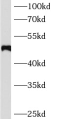 AGT antibody|AGT抗体 FNab00393