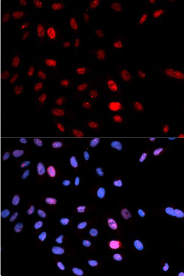 SMC1A antibody|SMC1A抗体