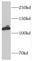 DIS3L antibody|DIS3L抗体