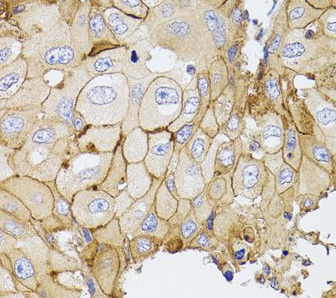 PDE4D antibody|PDE4D抗体