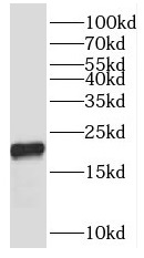 RPL12 antibody|RPL12抗体