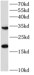 EIF4EBP1 antibody|EIF4EBP1抗体 F