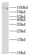 MOCOS antibody|MOCOS抗体