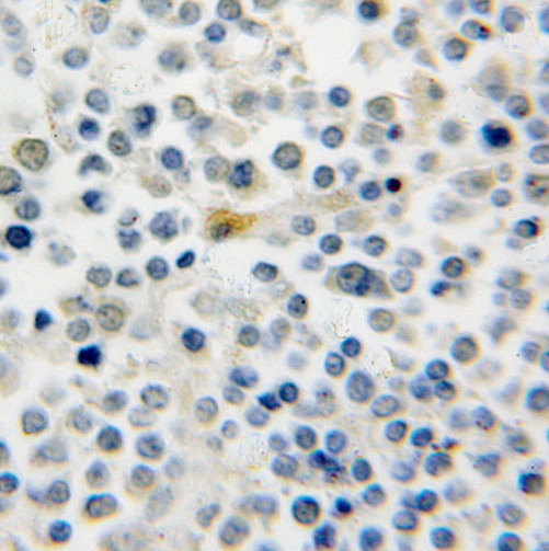 RAB39B antibody|RAB39B抗体