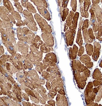 DES antibody|DES抗体 FNab02340