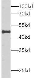 APOH antibody|APOH抗体 FNab00510