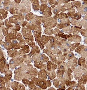 IL1RL1 antibody|IL1RL1抗体 FNab0