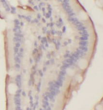 TRPV1 antibody|TRPV1抗体 FNab098