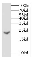 CRYGC antibody|CRYGC抗体